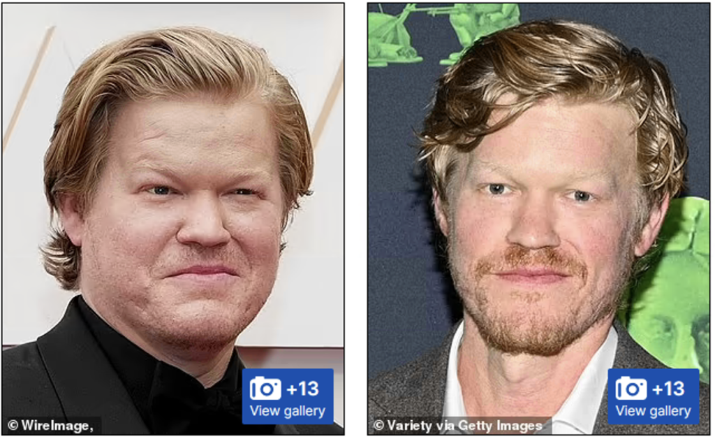 Jesse Plemons Ozempic face before and after photo