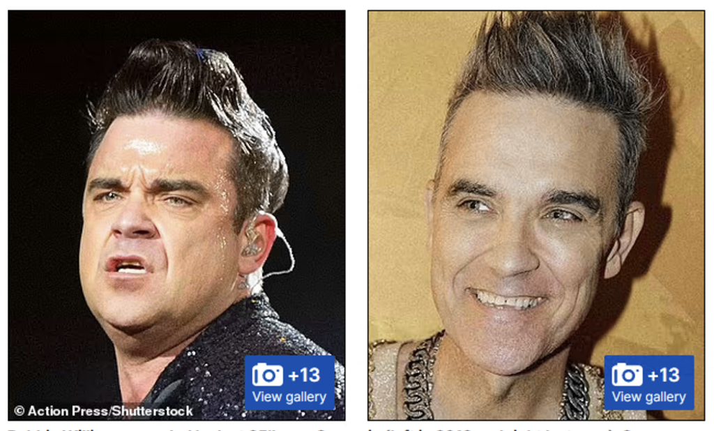 Robbie Williams Ozempic face before and after photos
